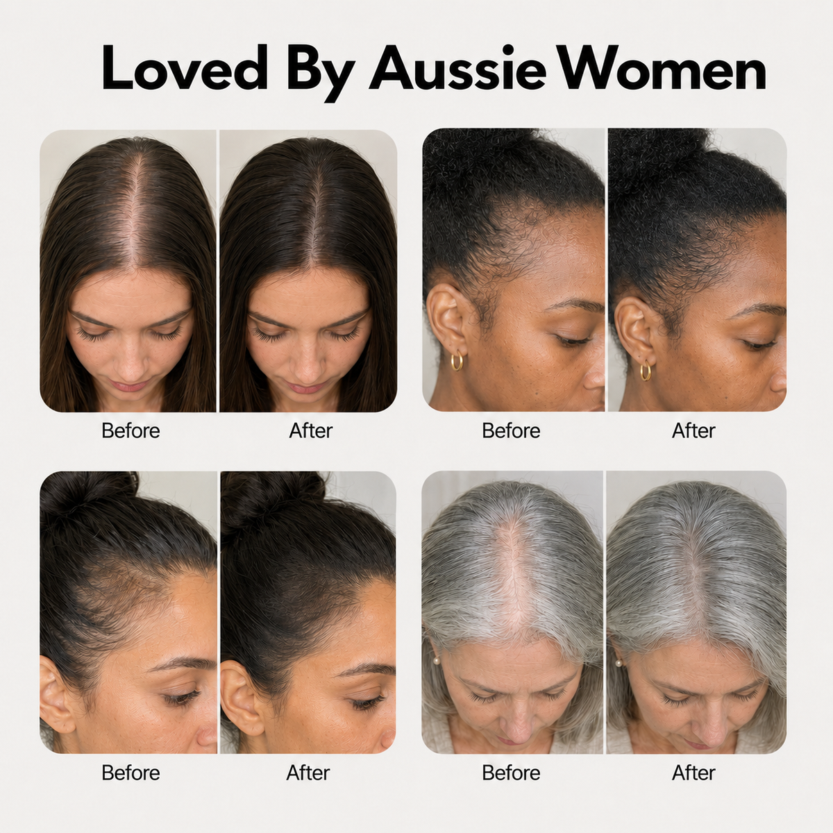 ReviveRoot™ Hair Growth Serum